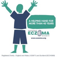 national eczema society