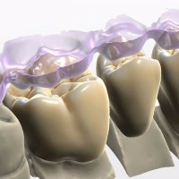 the bristol crown company limited