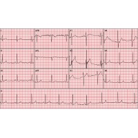 broomwell healthwatch limited