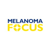 melanoma focus