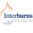 interburns limited