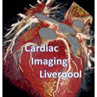 cardiac imaging liverpool ltd