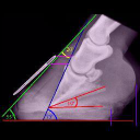 the laminitis site